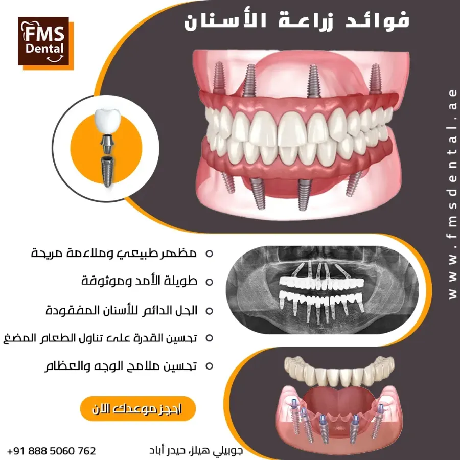 https://www.asuaqksa.com/node/98743